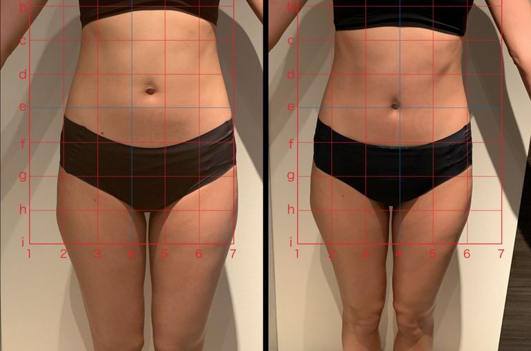 エムスレンダー